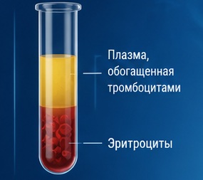 Микроинвазивная пролонгированная терапия в травматологии-ортопедии: протоколы 2026 года