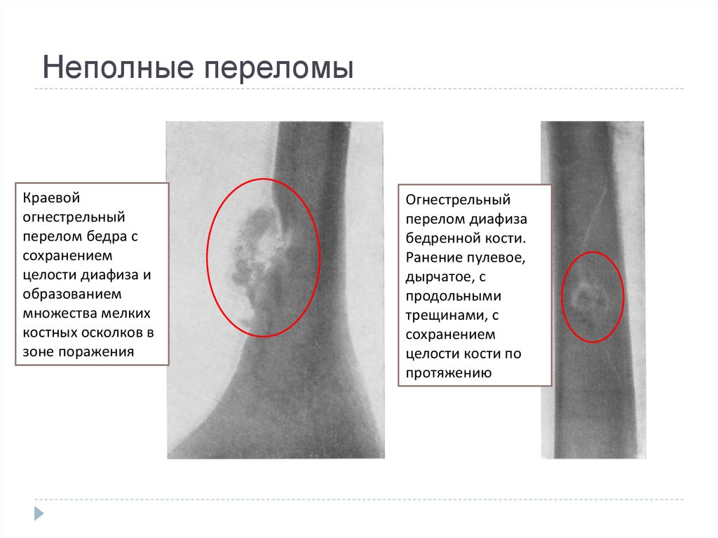 Как определяется степень тяжести боевого ранения: полный гид по законам, приказам и методикам