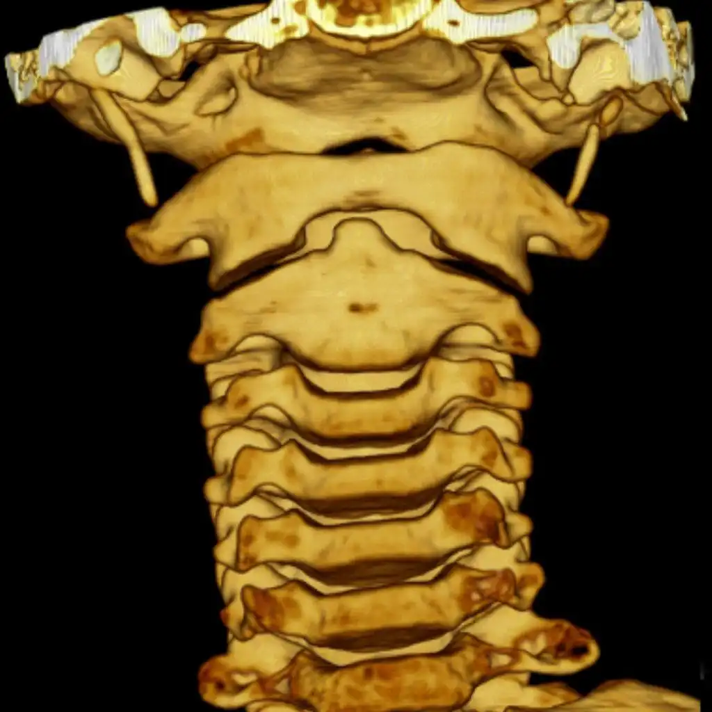 Зубовидная кость - диагностика в Тюмени