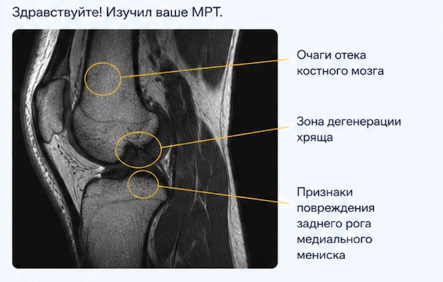 Второе мнение травматолога-ортопеда по МРТ онлайн: как получить точную диагностику без повторных визитов