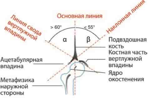 Дисплазия тбс у ребенка: подробно рассказывает врач ортопед