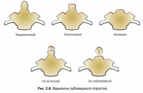 Варианты зубовидного отростка