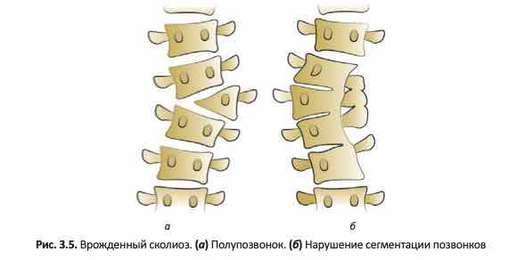 Полупозвонок