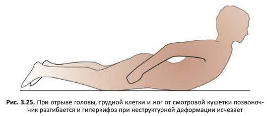 Тест на гиперкифоз