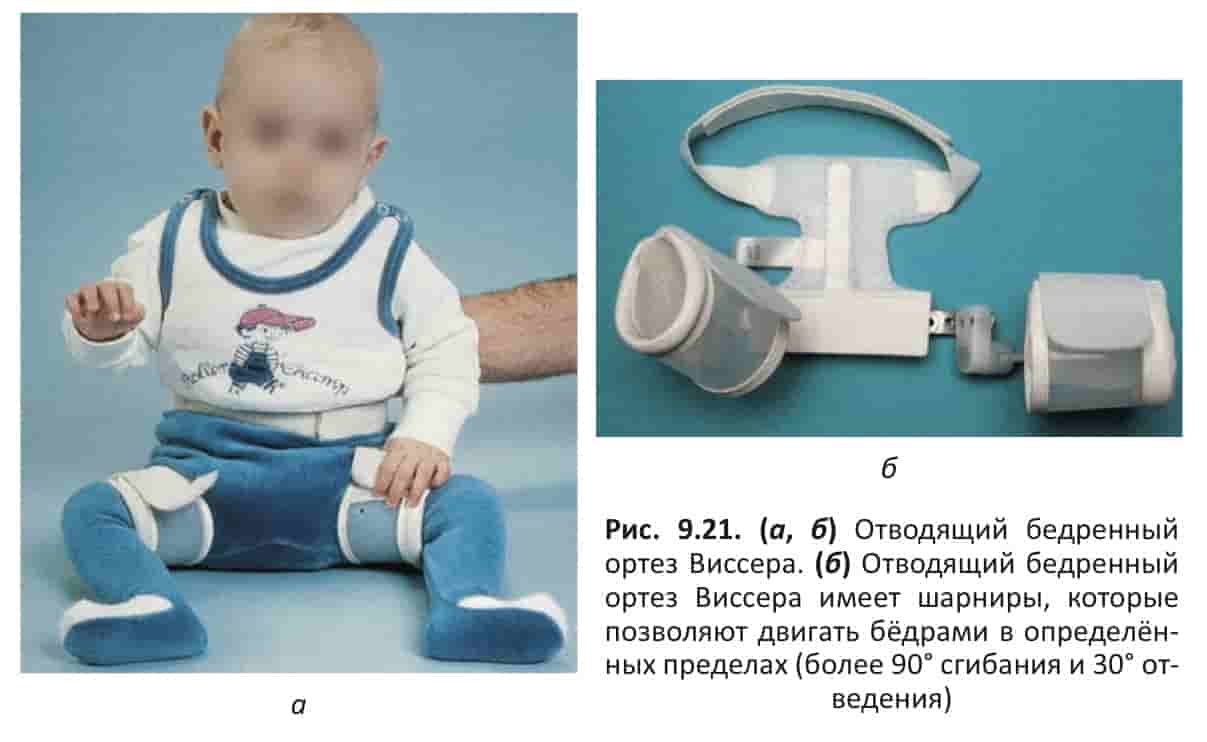 ортез Виссера (Visser)