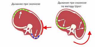 Дыхательная гимнастика по методу Катарины Шрот