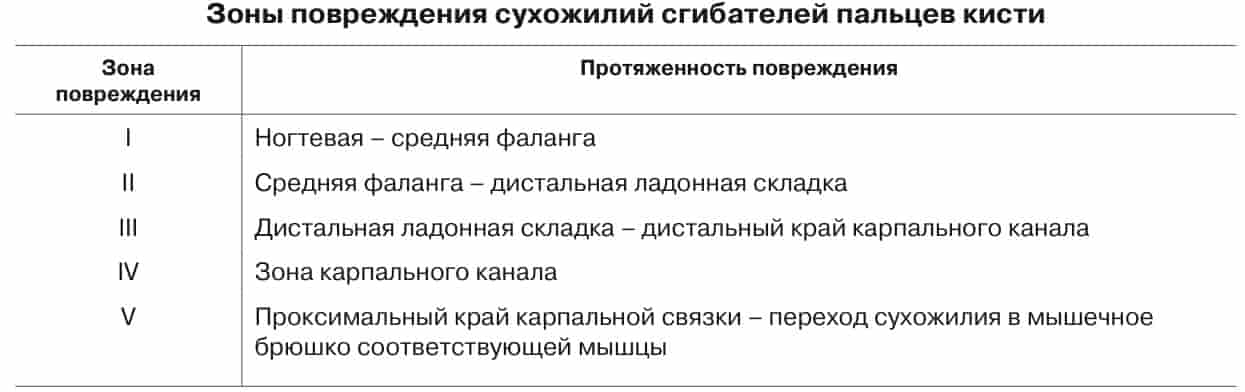 Зоны повреждения сухожилий сгибателей