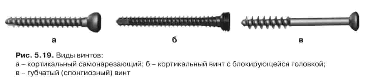 Винты для остеосинтеза