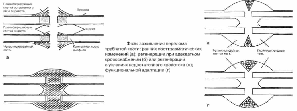 Фазы сращения кости