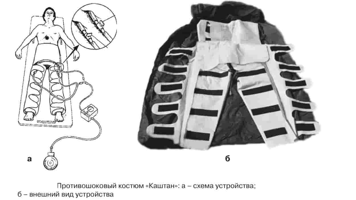 противошоковый костюм